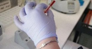 Casi di Chikungunya, stop alle donazioni di sangue ad Anzio